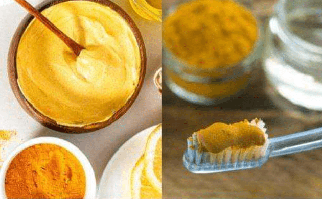 Scopri le meraviglie naturali che la curcuma può fare per la salute dei tuoi denti.