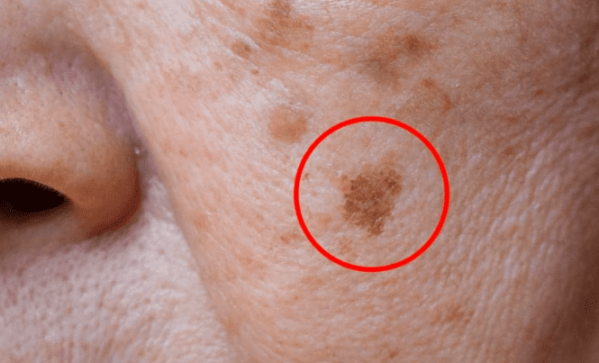 Tonico di rosmarino per rughe e macchie della pelle: una soluzione naturale ed efficace