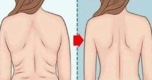 Ecco il modo migliore per usare il bicarbonato di sodio per perdere peso su braccia e addome