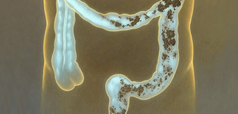 Express Detox: purifica il tuo intestino in meno di una settimana con questo duo naturale