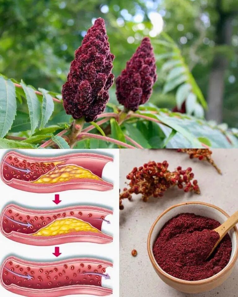 Se vedi questo albero, sei seduto sull'oro