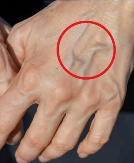 Modi naturali per migliorare la salute delle vene e della pelle