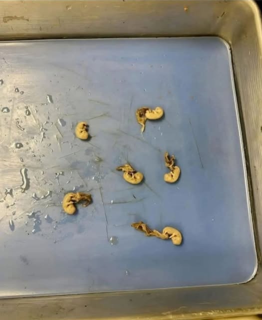 Sembrano piccoli semi ma sono... Vedi altro