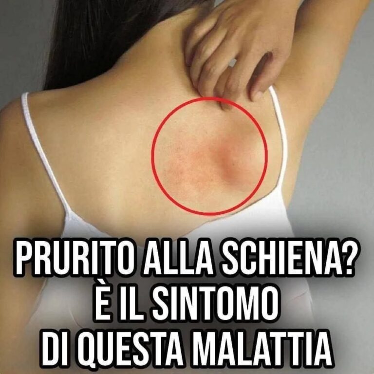 Prurito in tutto il corpo: quali sono le cause e rimedi naturali