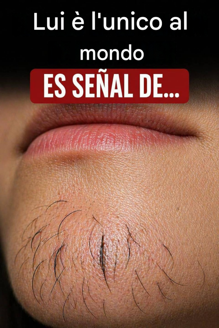 Peli sul mento nelle donne: cause e falsi miti